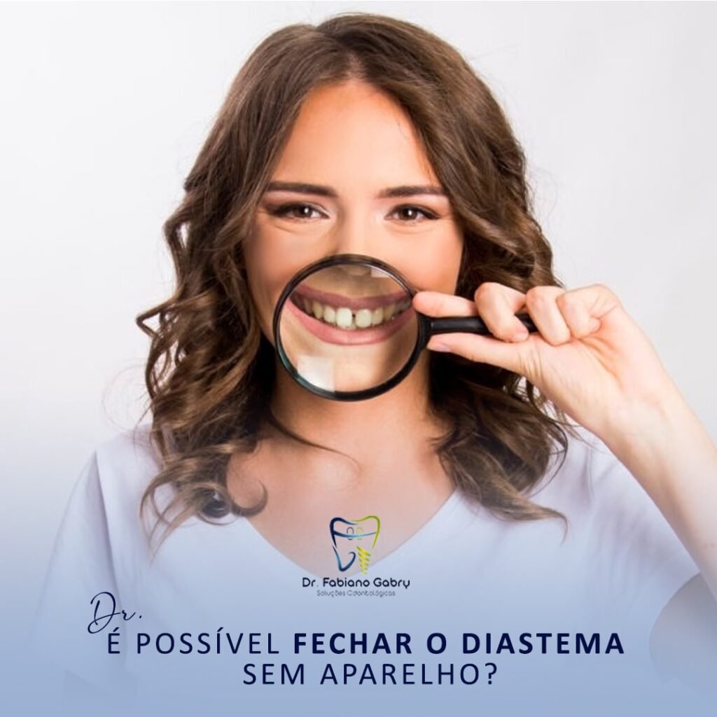 DIASTEMA Dr Fabiano Gabry