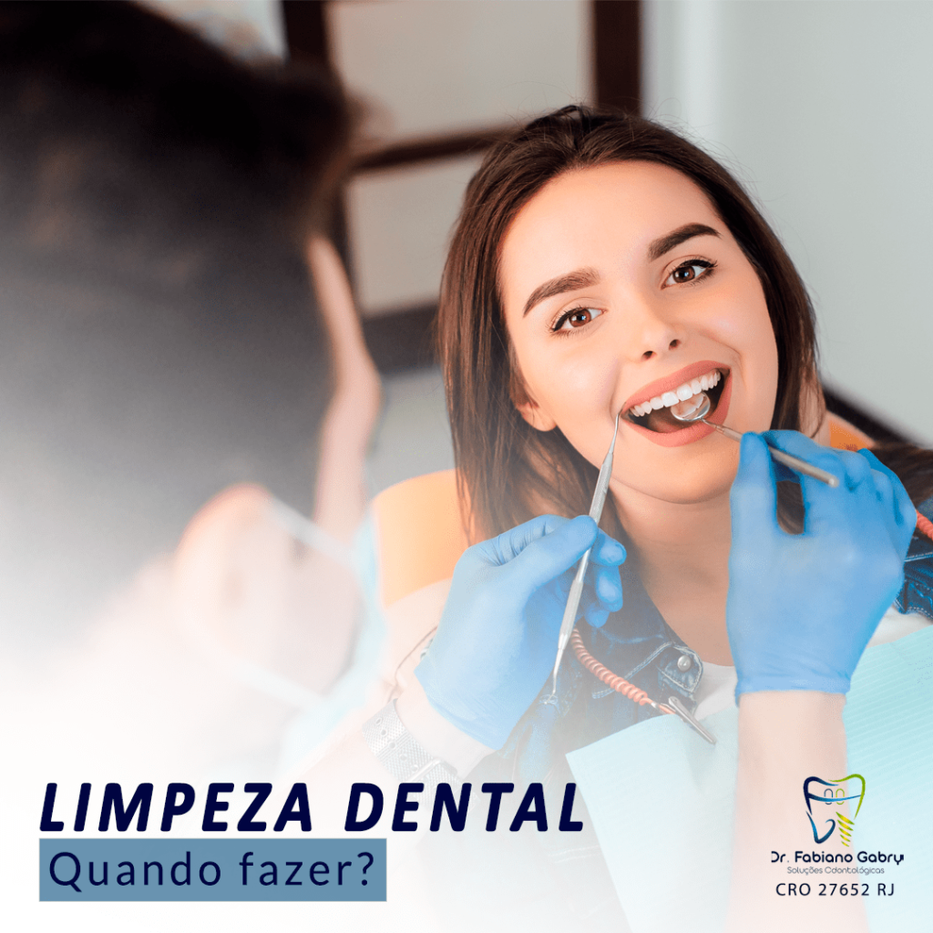 Saiba Tudo Sobre Limpeza Dental Dr Fabiano Gabry